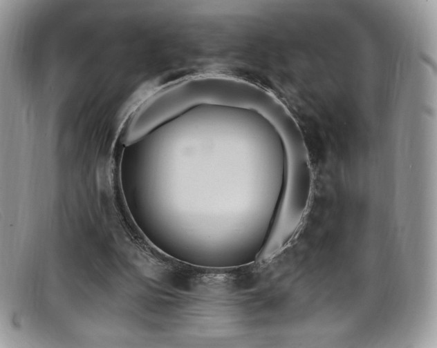 X0000099320152200805021321