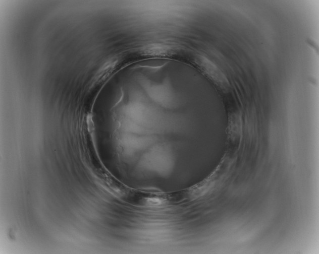 X0000099320167200805021321