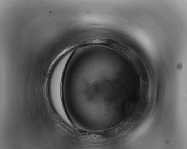 X0000099320387200805091046