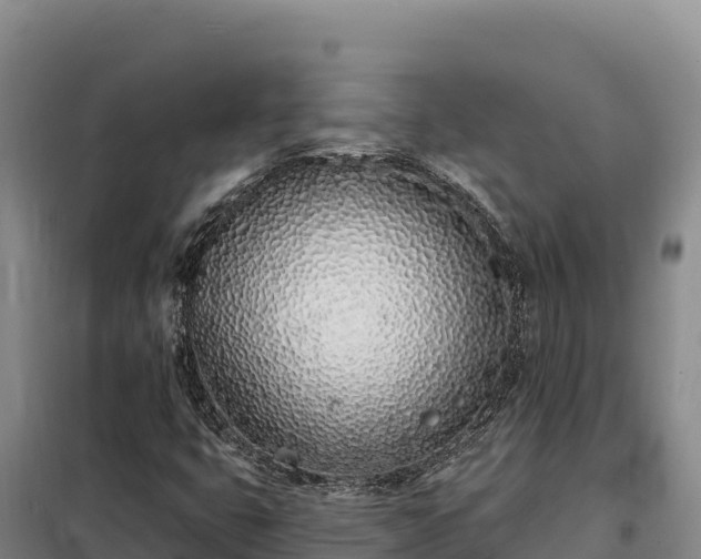 X0000099321399200805091030