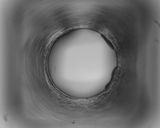 X0000099320001200805161411