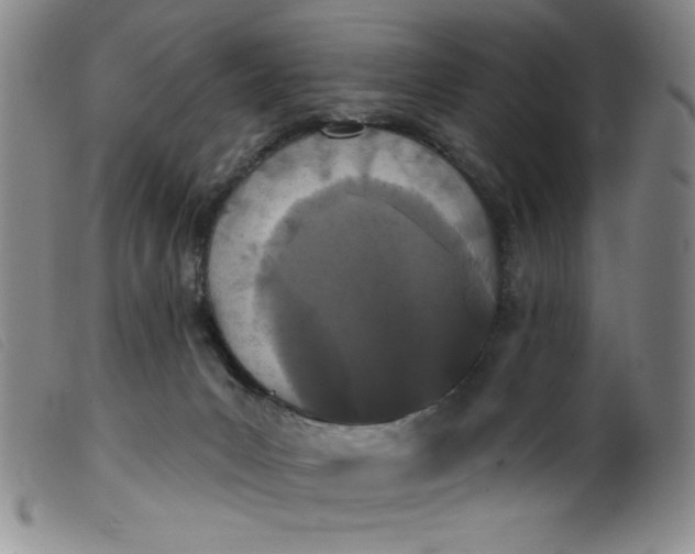 X0000099320031200805161411