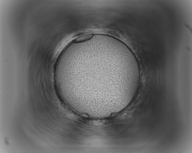 X0000099320103200805161410