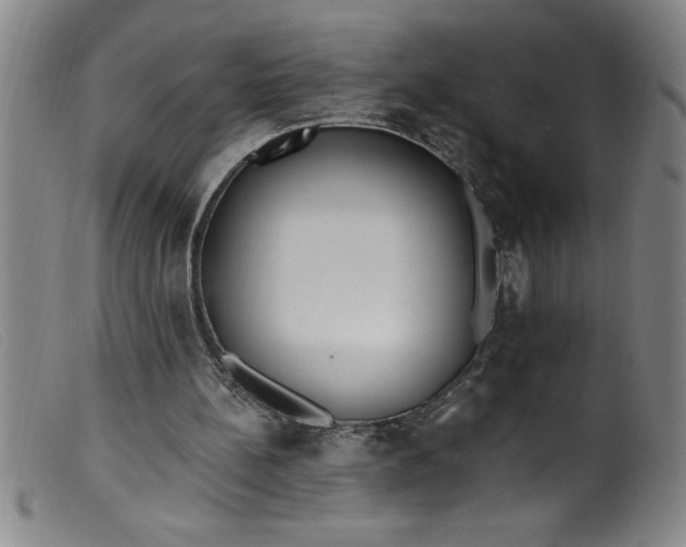 X0000099320148200805161408