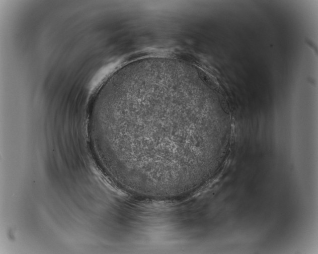 X0000099320149200805161408