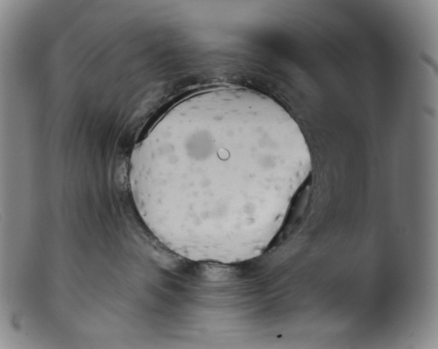 X0000099320336200805161406