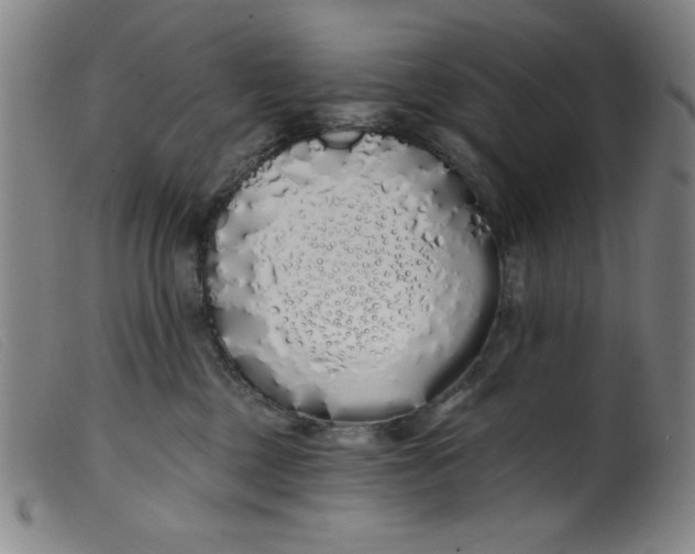 X0000099320377200805161406