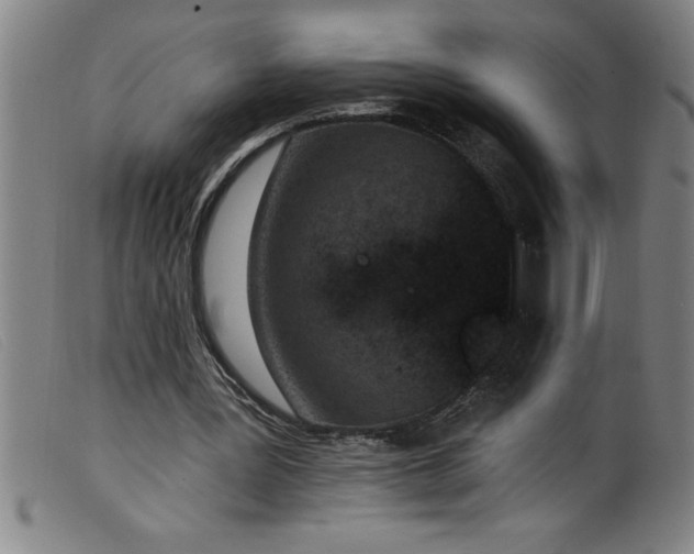 X0000099320387200805161406