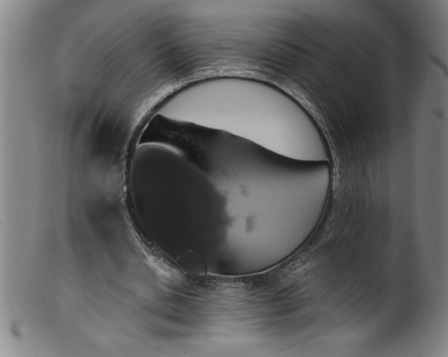 X0000099320438200805161404