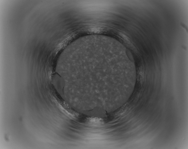 X0000099320500200805161404