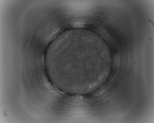 X0000099320600200805161402