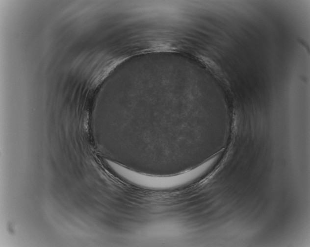 X0000099321161200805161354