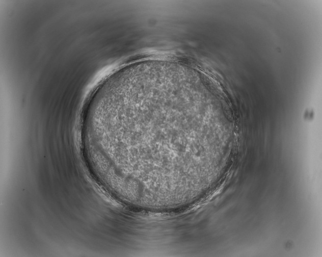 X0000099320149200805231432