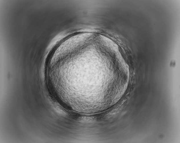 X0000099320296200805231431