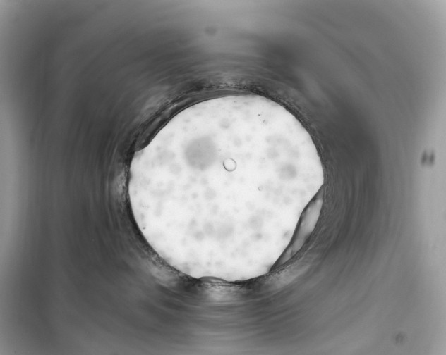 X0000099320336200805231430