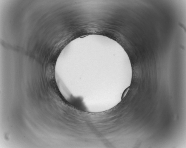 X0000099320043200805301225