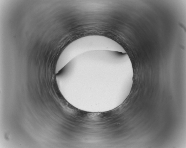 X0000099320136200805301224