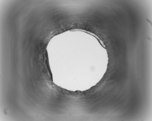 X0000099320144200805301223