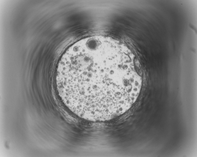 X0000099320145200805301223