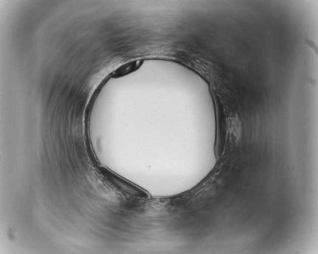 X0000099320148200805301223