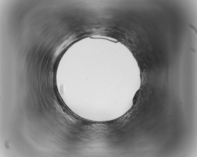 X0000099320150200805301223