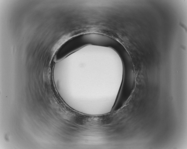X0000099320152200805301223