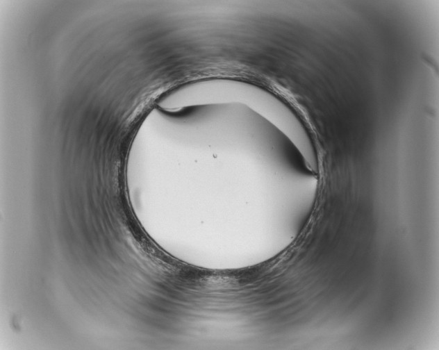 X0000099320154200805301223