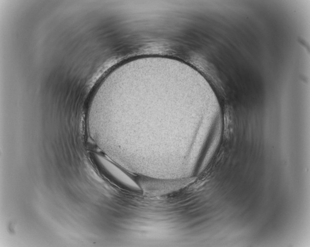 X0000099320156200805301223