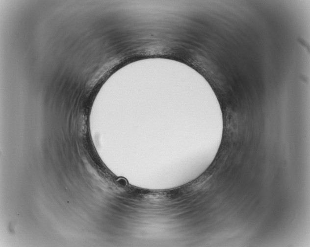X0000099320164200805301223