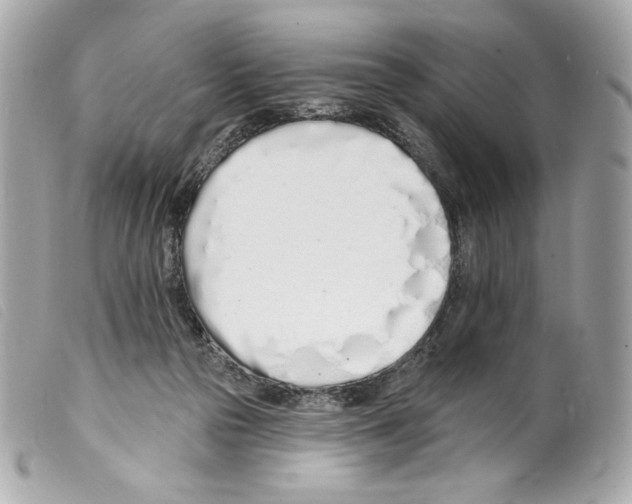 X0000099320169200805301223
