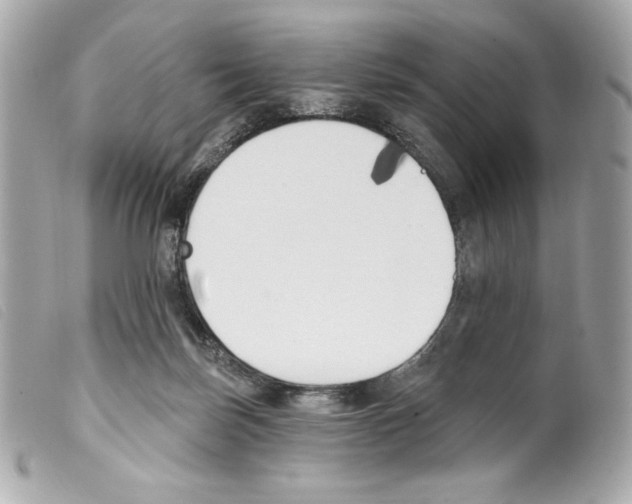 X0000099320171200805301223