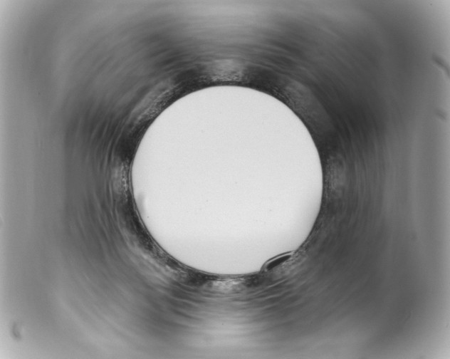 X0000099320172200805301223