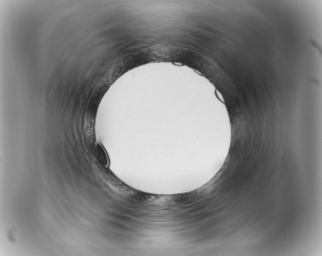 X0000099320186200805301223