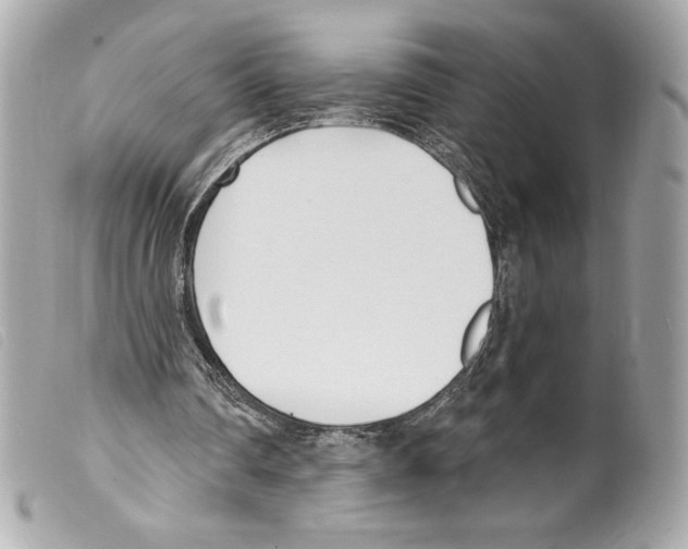 X0000099320290200805301221