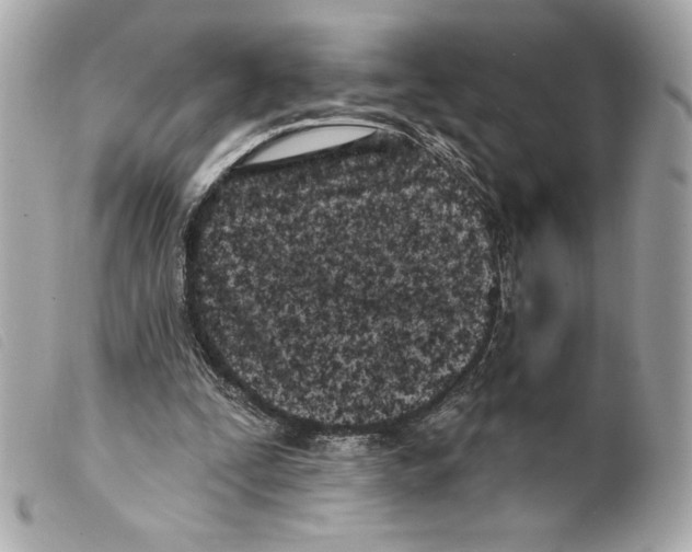 X0000099320295200805301221