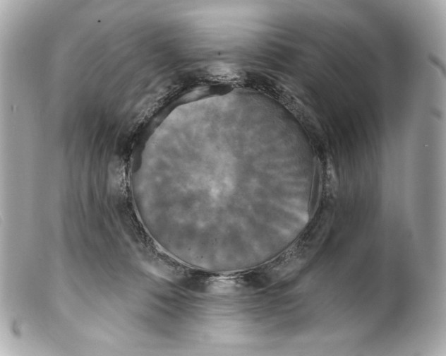 X0000099320320200805301221