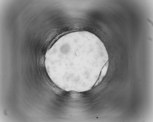 X0000099320336200805301221