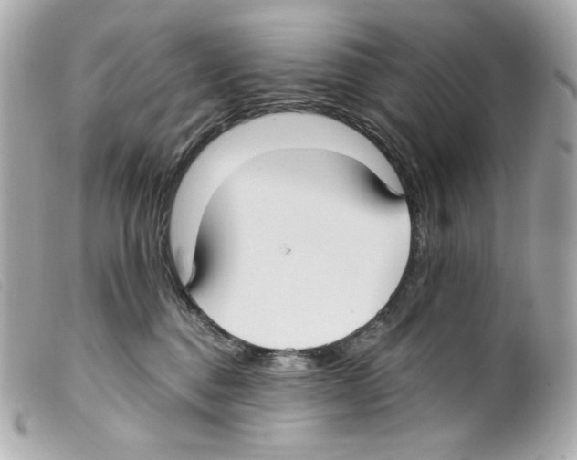 X0000099320376200805301221