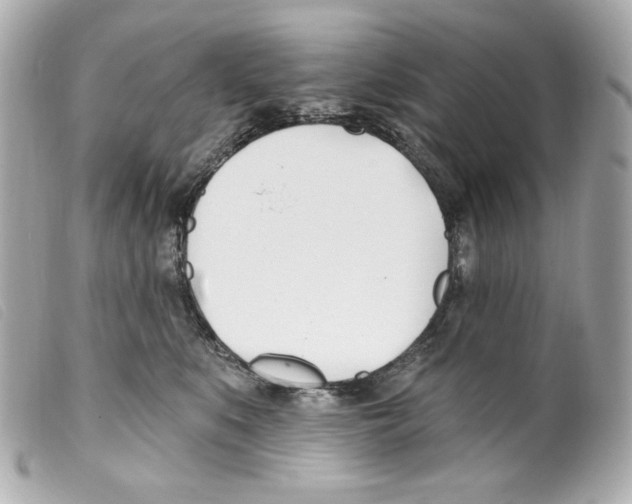 X0000099320519200805301218