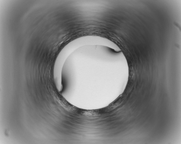 X0000099320568200805301218
