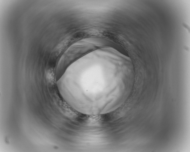 X0000099320720200805301215