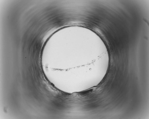 X0000099321336200805301207