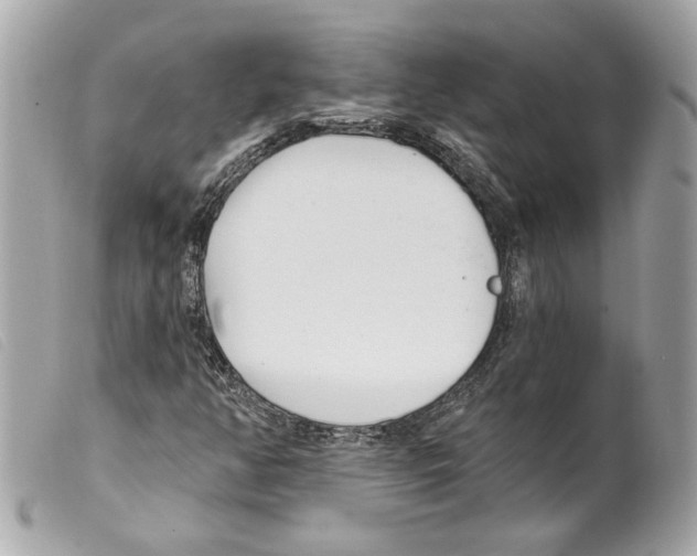 X0000099321350200805301207