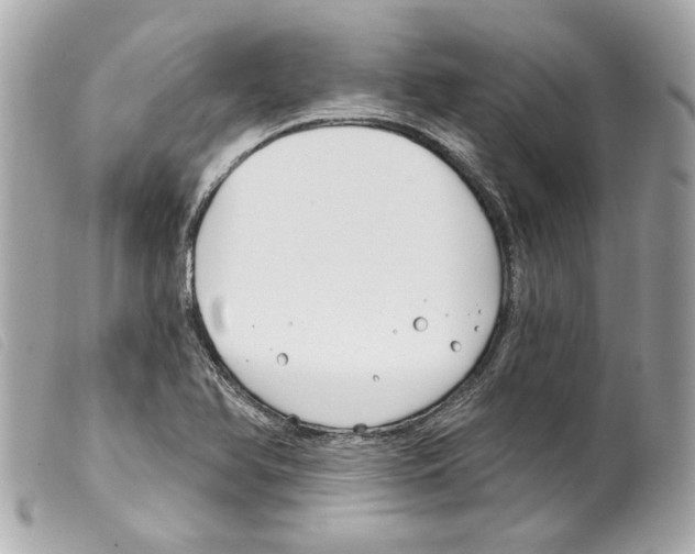 X0000099321366200805301206