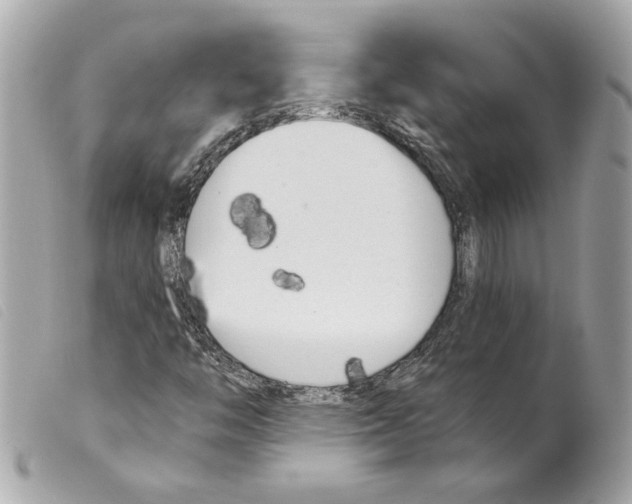 X0000099321446200805301205