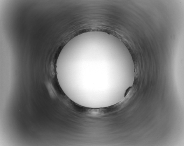 X0000099380187200805081207