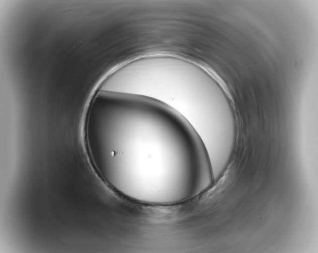 X0000099381197200805081153