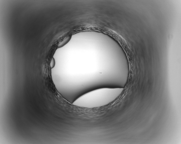 X0000099381207200805081152