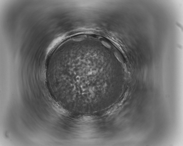 X0000099380149200805081453