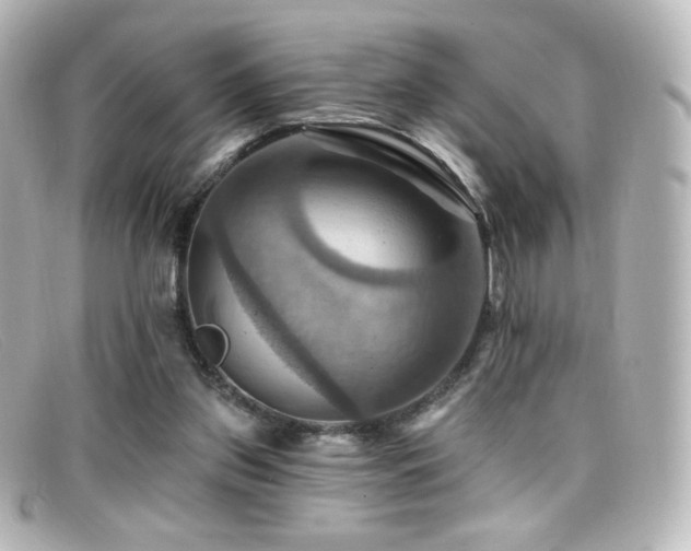 X0000099380157200805081453